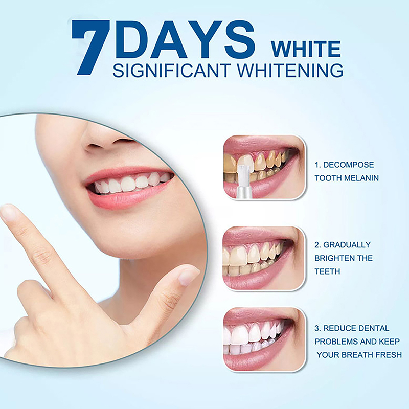 ปากกาฟอกฟันขาว เจลฟอกฟันขาวระด - Teeth Whitening Bleaching Kit บทวิจารณ์และราคา