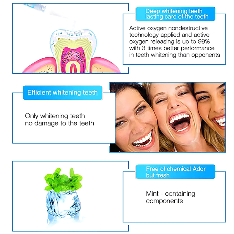 ปากกาฟอกฟันขาว เจลฟอกฟันขาวระด - Teeth Whitening Bleaching Kit บทวิจารณ์และราคา