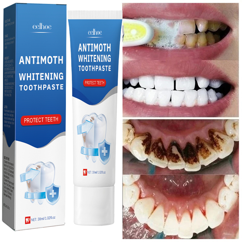 Fast ลบคราบควันยาสีฟันลบคราบจุ - Teeth Whitening Fast บทวิจารณ์และราคา