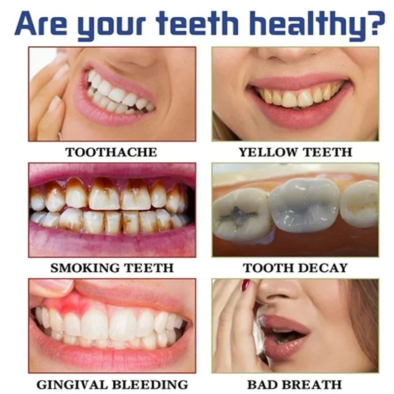 Fast ลบคราบควันยาสีฟันลบคราบจุ - Teeth Whitening Fast บทวิจารณ์และราคา