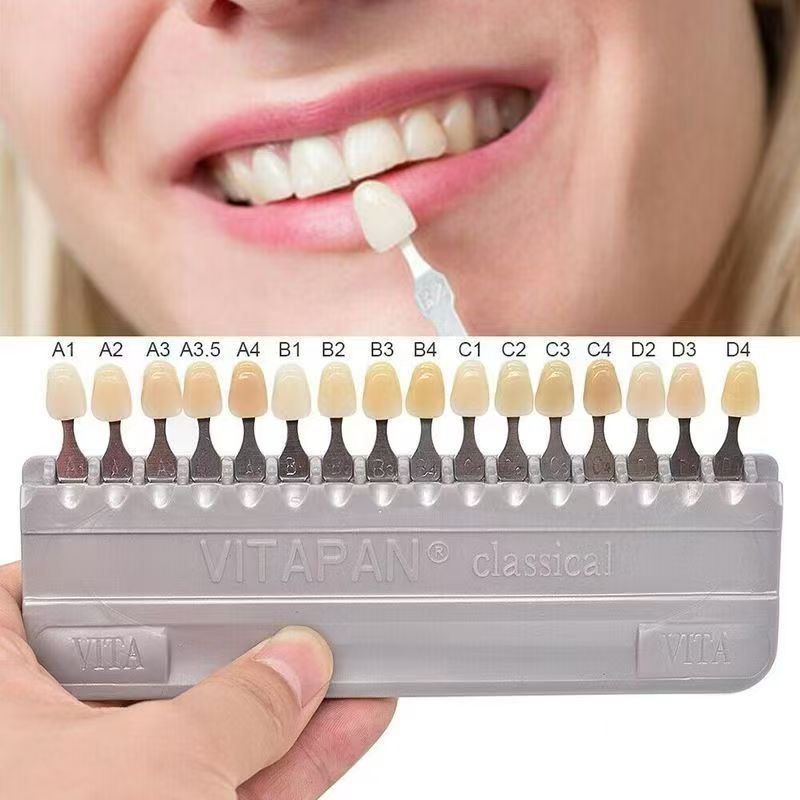 แผ่นสีฟัน VITA 16 สี แบบคลาสสิ - Teeth Whitening Free บทวิจารณ์และราคา