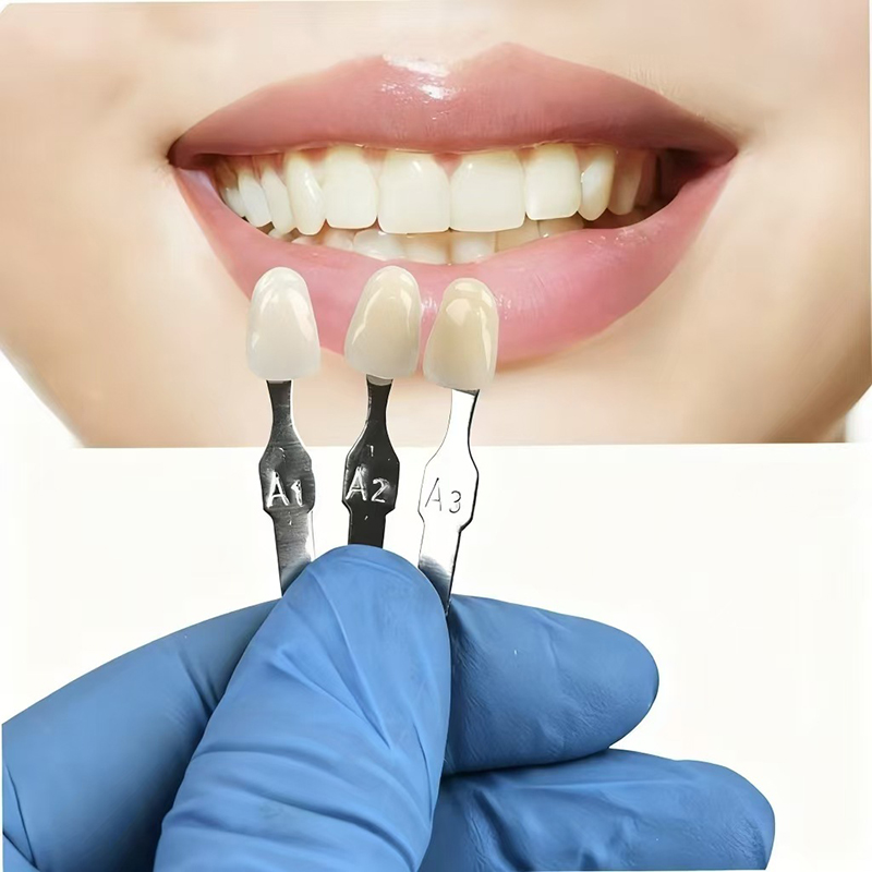 แผ่นสีฟัน VITA 16 สี แบบคลาสสิ - Teeth Whitening Free บทวิจารณ์และราคา