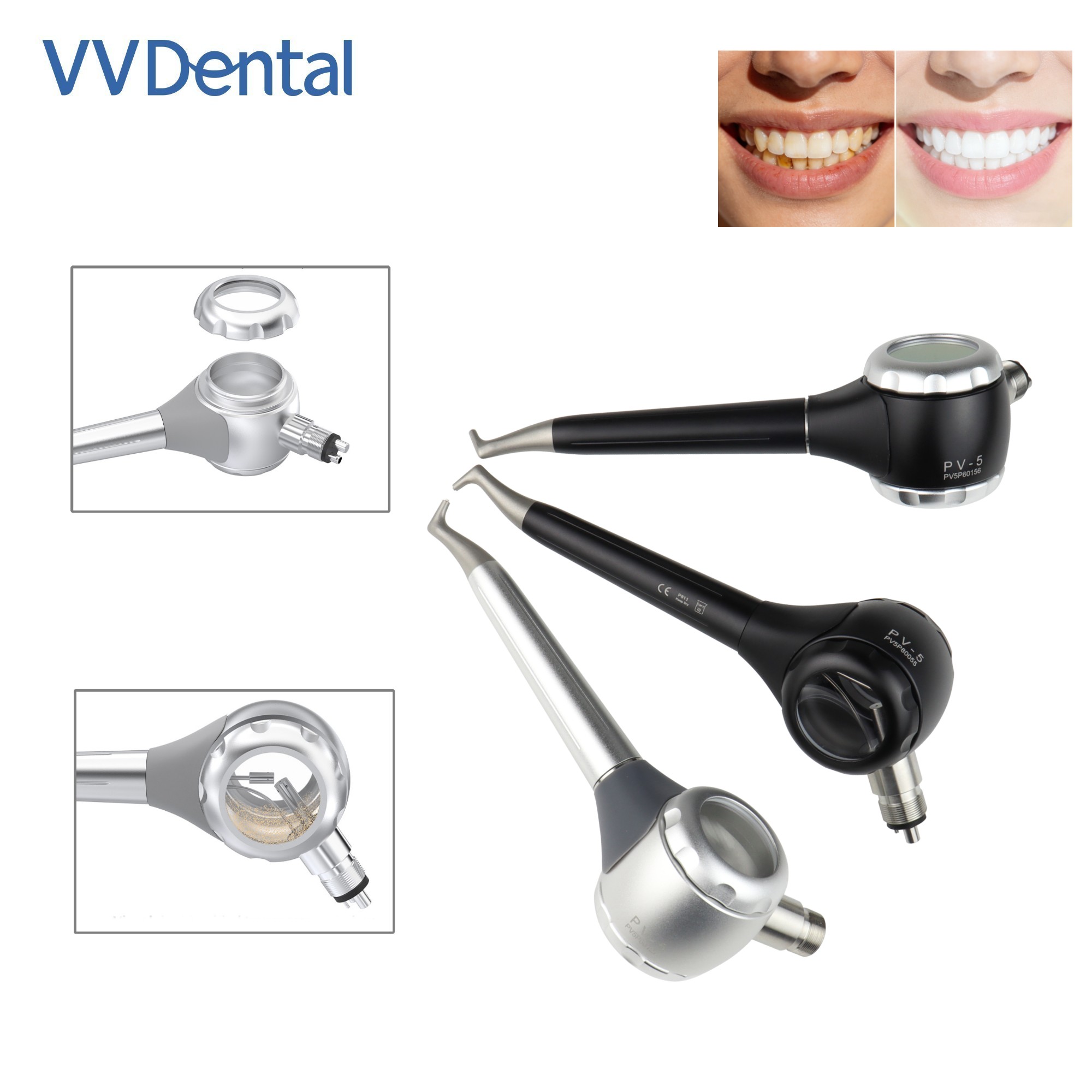ปืนพ่นทรายฟอกสีฟัน VV Dental 2 - Teeth Whitening Free บทวิจารณ์และราคา