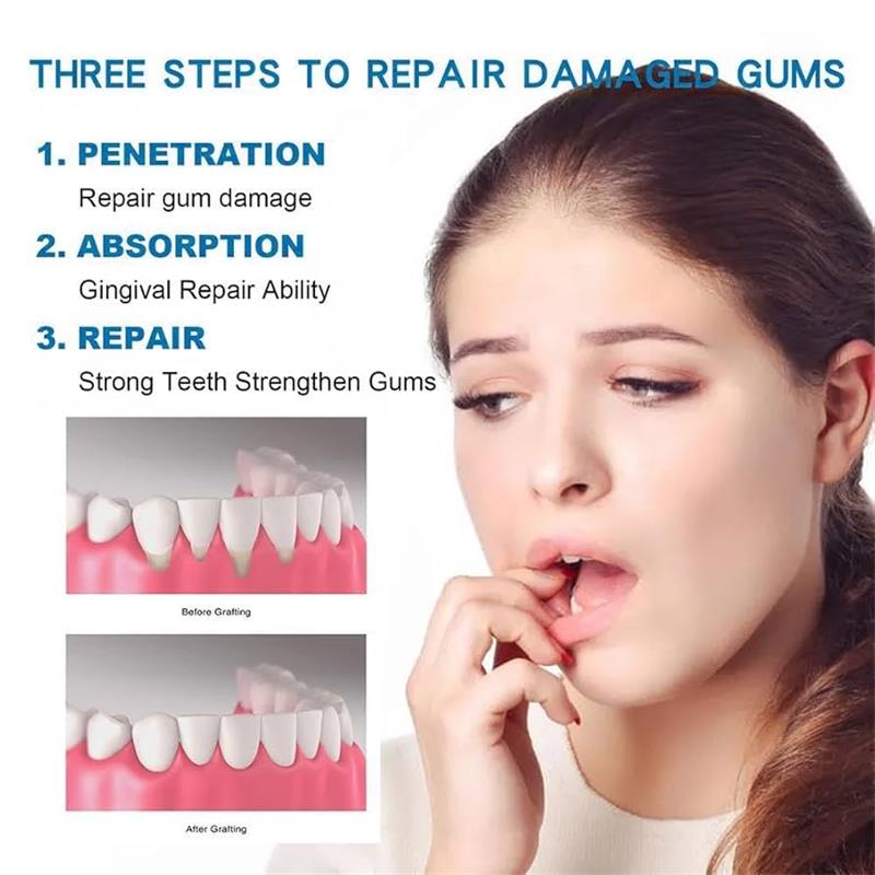 เซรั่มบำรุงเหงือก แก้ปัญหาเหงื - Teeth Whitening Gingival Barrier บทวิจารณ์และราคา