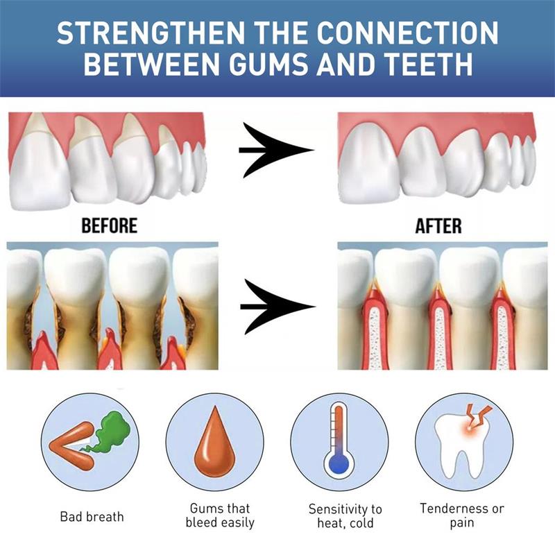 เซรั่มบำรุงเหงือก แก้ปัญหาเหงื - Teeth Whitening Gingival Barrier บทวิจารณ์และราคา