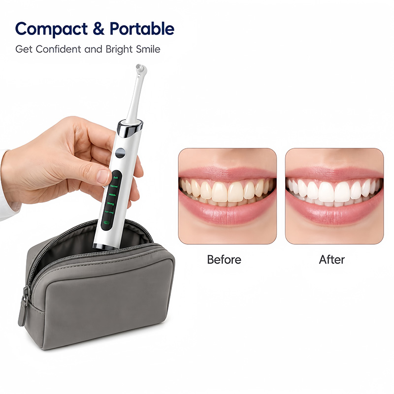 ชุดขัดฟันและฟอกสีฟันสำหรับทำคว - Teeth Whitening Light Kit บทวิจารณ์และราคา
