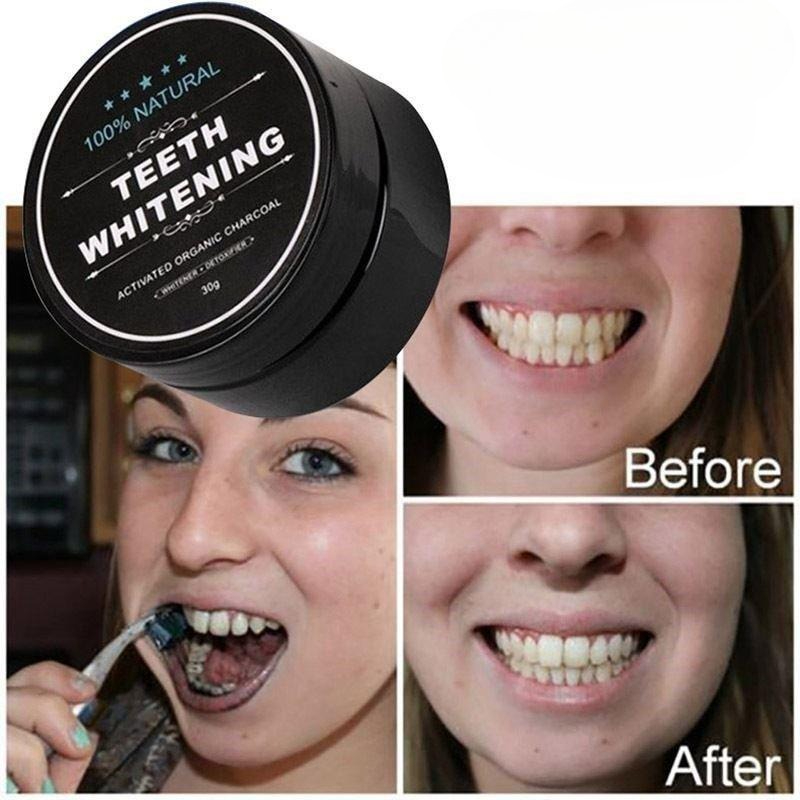 ผงฟอกสีฟันถ่านกัมมันต์ 1 กล่อง - Teeth Whitening Zimba บทวิจารณ์และราคา