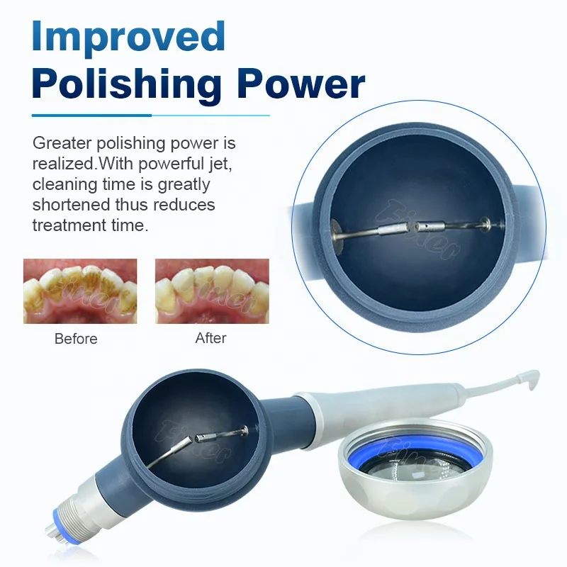 โปรฟี่เมท ระบบทำความสะอาดฟันด้ - Teeth Whitening Fast บทวิจารณ์และราคา