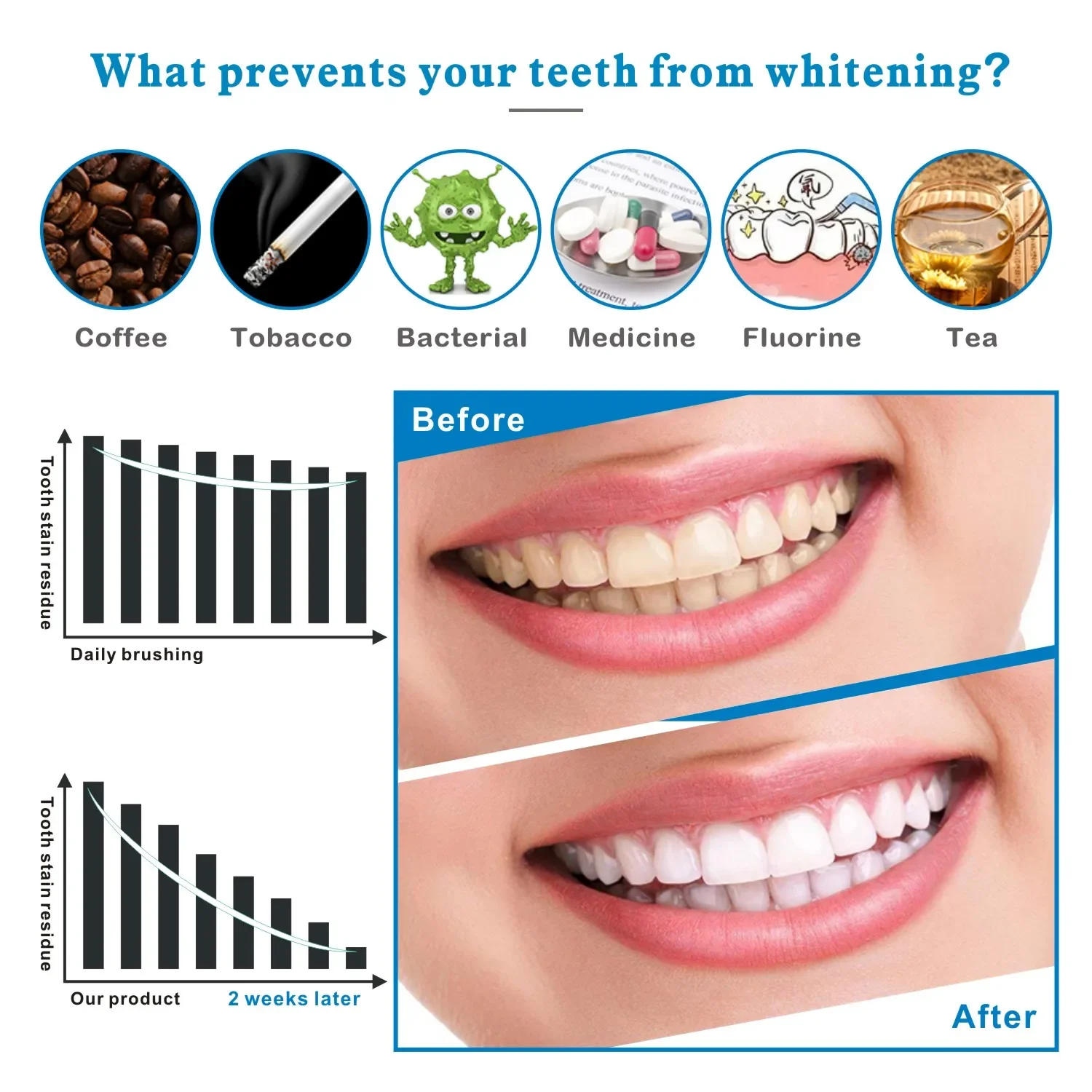 14/28pcs 3D ฟันไวท์เทนนิ่งแถบ  - Whitening Strip 3D บทวิจารณ์และราคา