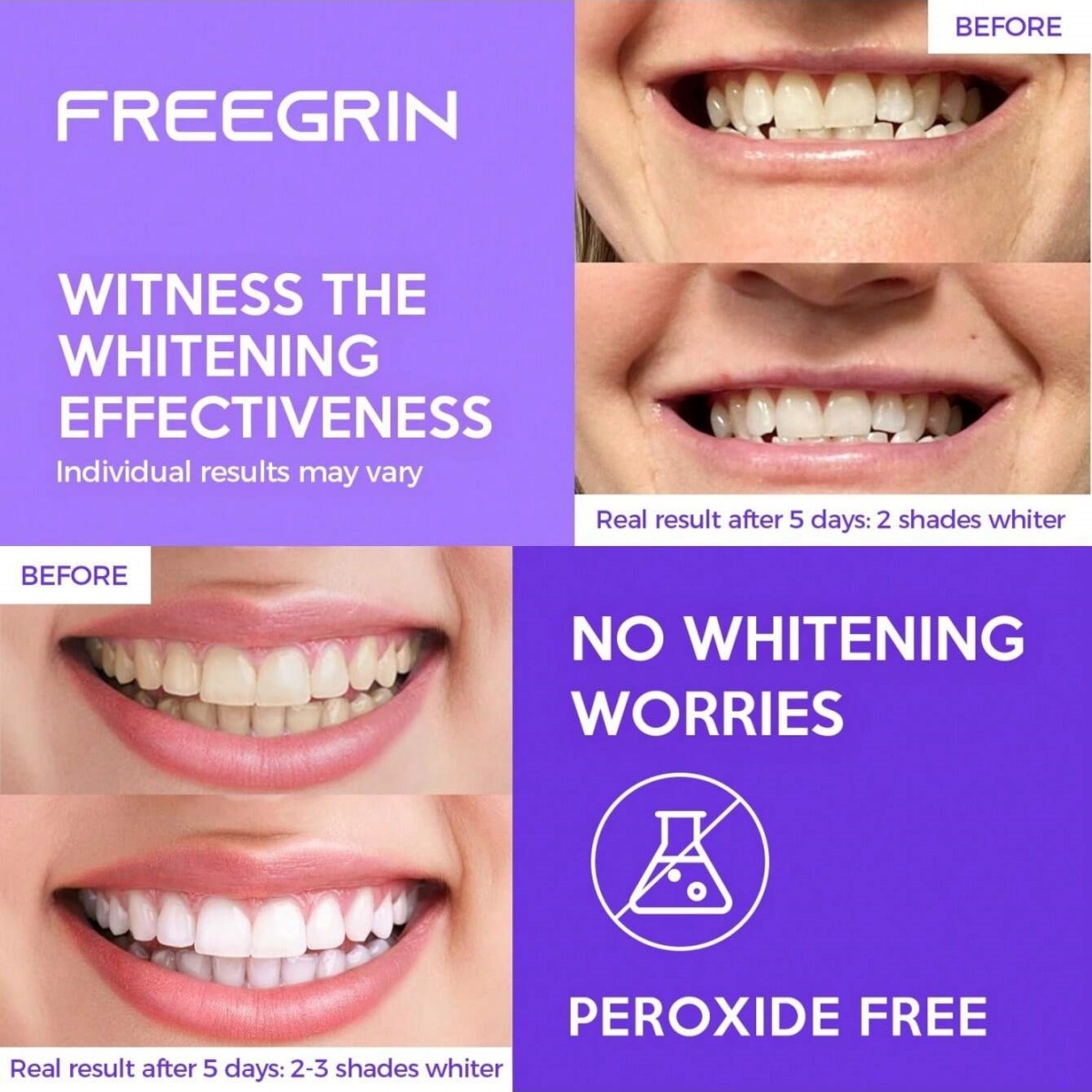 ดีลักซ์สติกเกอร์ฟอกสีฟัน 7/14/ - Teeth Whitening Quotes บทวิจารณ์และราคา