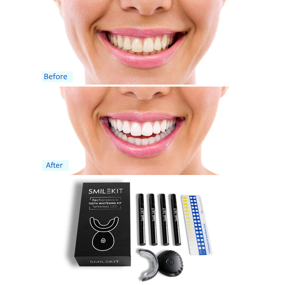 ใหม่ไฟฟ้าฟอกสีฟัน LED บ้านไร้ส - Teeth Whitening Bleaching Kit บทวิจารณ์และราคา