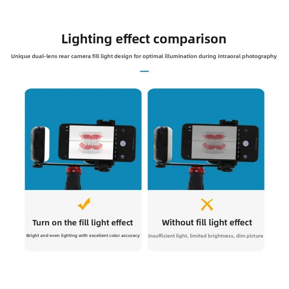 ไฟถ่ายภาพทางทันตกรรม, แฟลช LED - Teeth Whitening Flash บทวิจารณ์และราคา