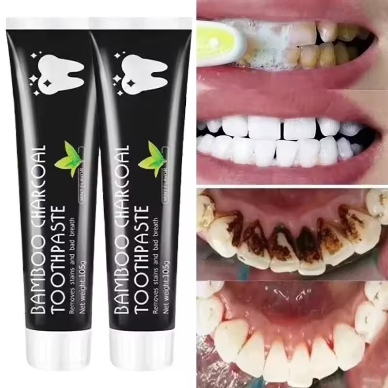 ยาสีฟันไวท์เทนนิ่ง ยาสีฟันถ่าน - Teeth Whitening Zimba บทวิจารณ์และราคา